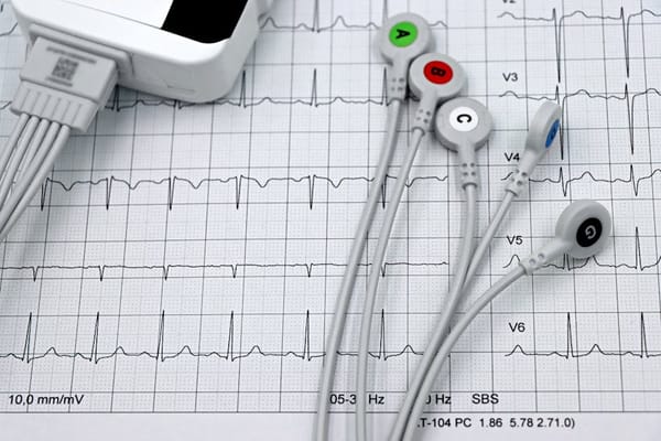The Cardiovascular Tests You Should Have Before 40